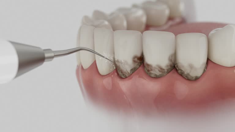 Reliable Dental contractor in Lamar, MO by Dentist Open Now